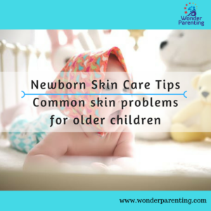 Newborn skin care tips _ Common skin problems for older children